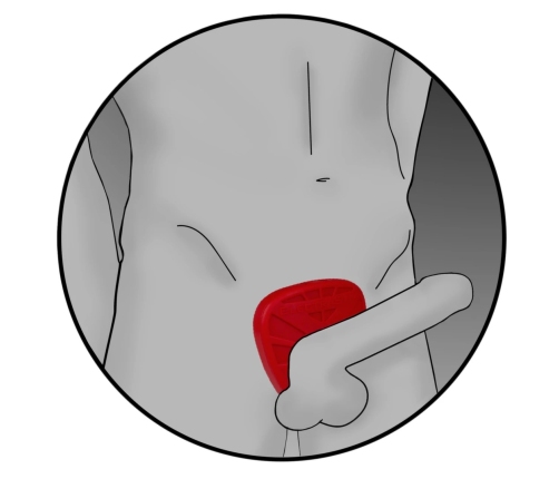 ElectraStim - Silicone Fusion Viper