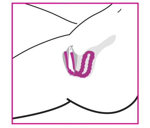 Petal Pusher - Silicone Labia Spreader