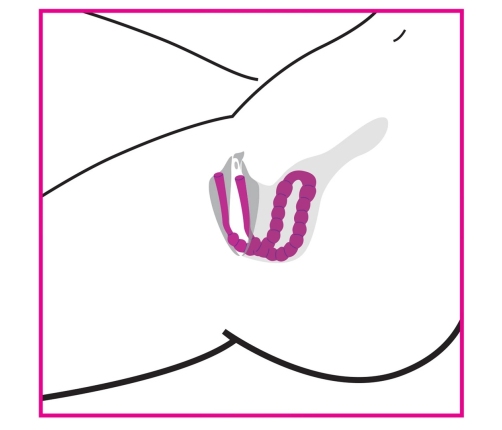 Petal Pusher - Silicone Labia Spreader