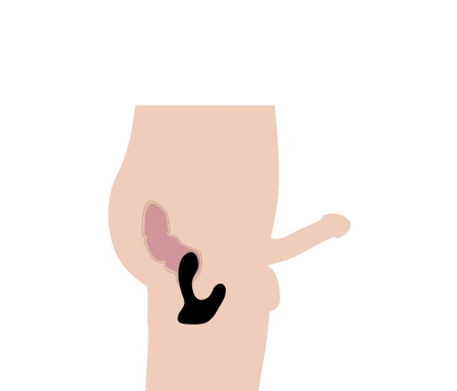 Silicone Prostate Stimulator + Remote Control with 10 Speeds