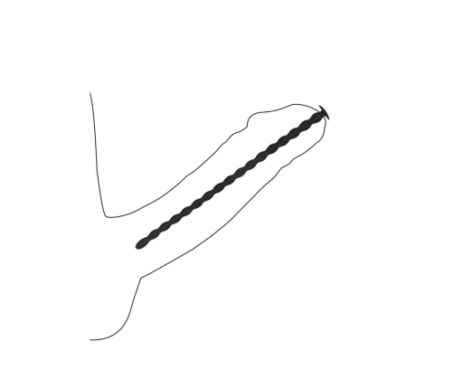 Silicone Spiral Screw Plug Set Advanced